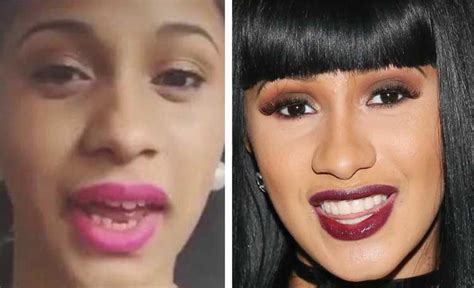 cardi b teeth before surgery|cardi b lipstick on teeth.